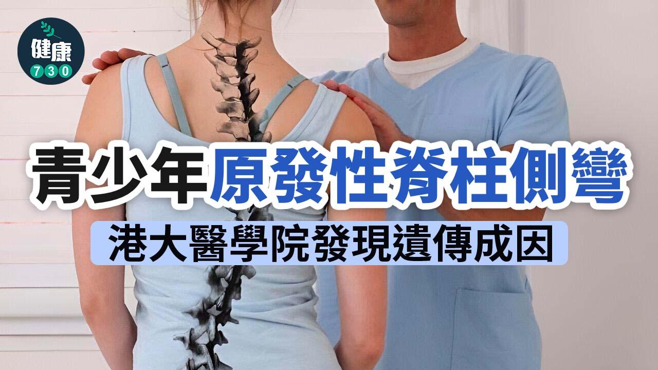 青少年原發性脊柱側彎 港大醫學院發現遺傳成因