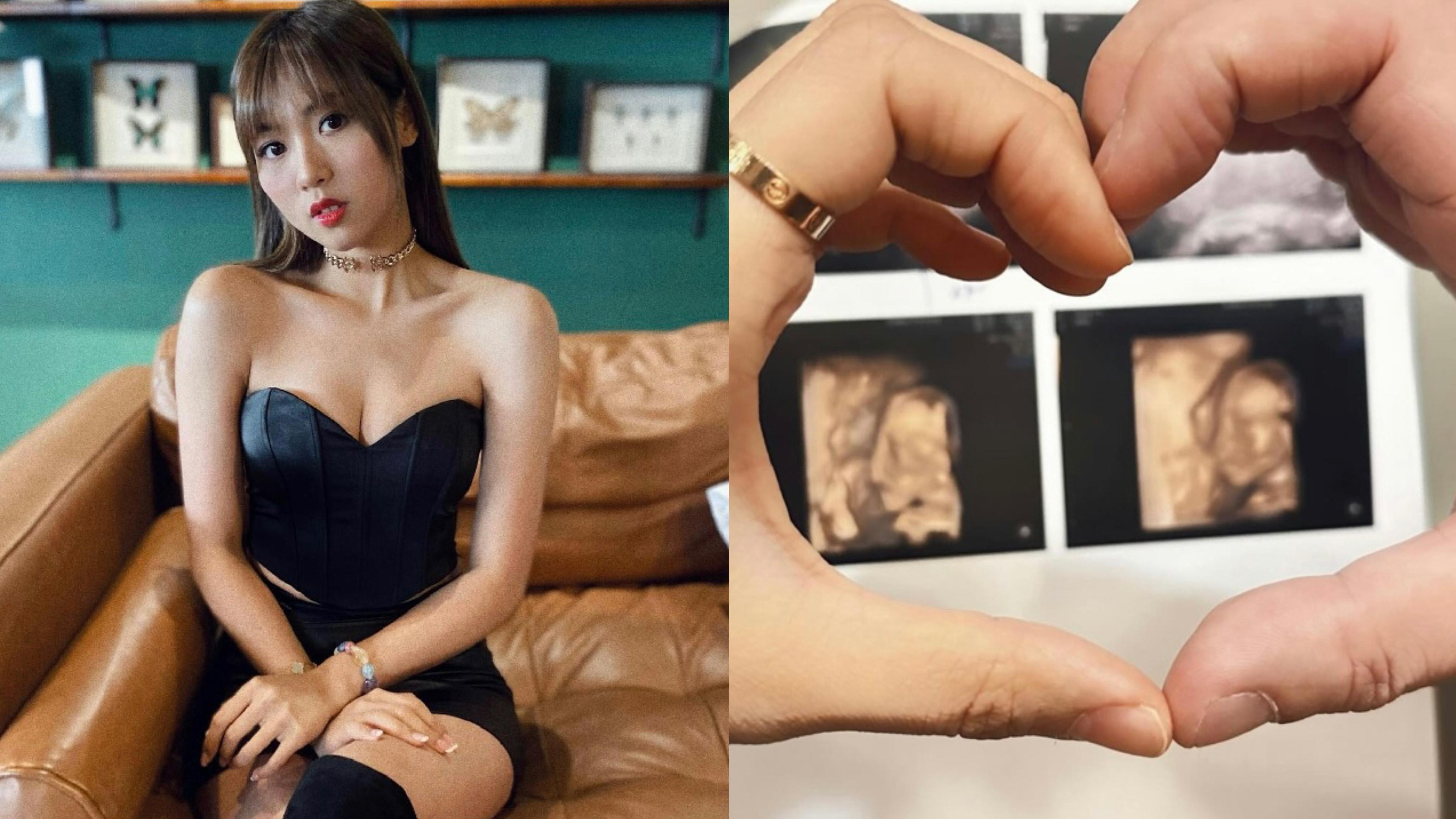 口罩小姐「浩南」鄭伊琪秘密嫁人 宣布懷孕5個月: 唔好再話我肥咗