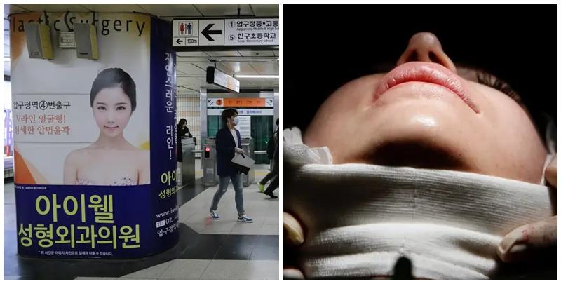 整容意外｜赴韓國兩周抽脂三次 20歲女子手術後亡  （資料圖片，圖非當事人）