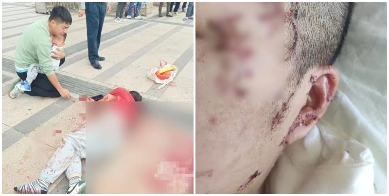 內媒報道，廣東惠州市一名黃姓女子上月在公園遊玩期間，被一名陌生男子無故用剪刀捅傷，全身有超過30處傷口。黃女被送院搶救，疑犯傷人後跳樓自殺身亡。