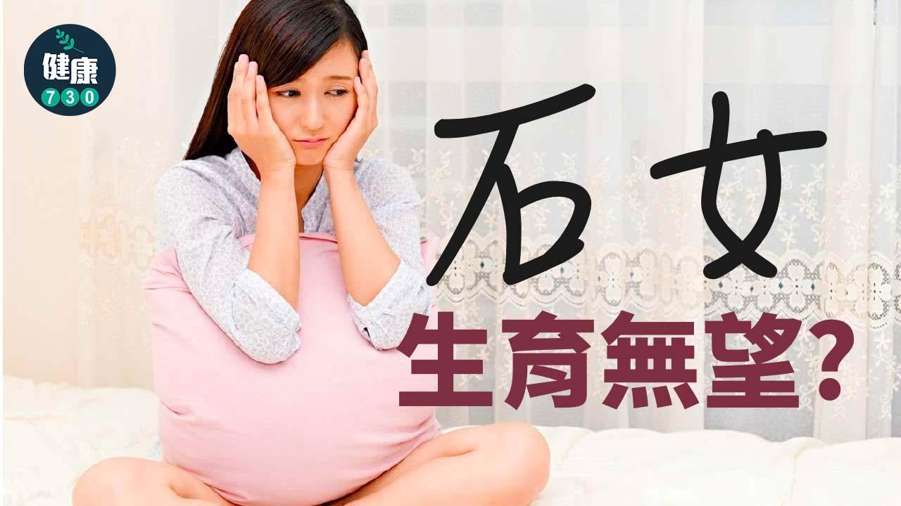 石女 生育無望？