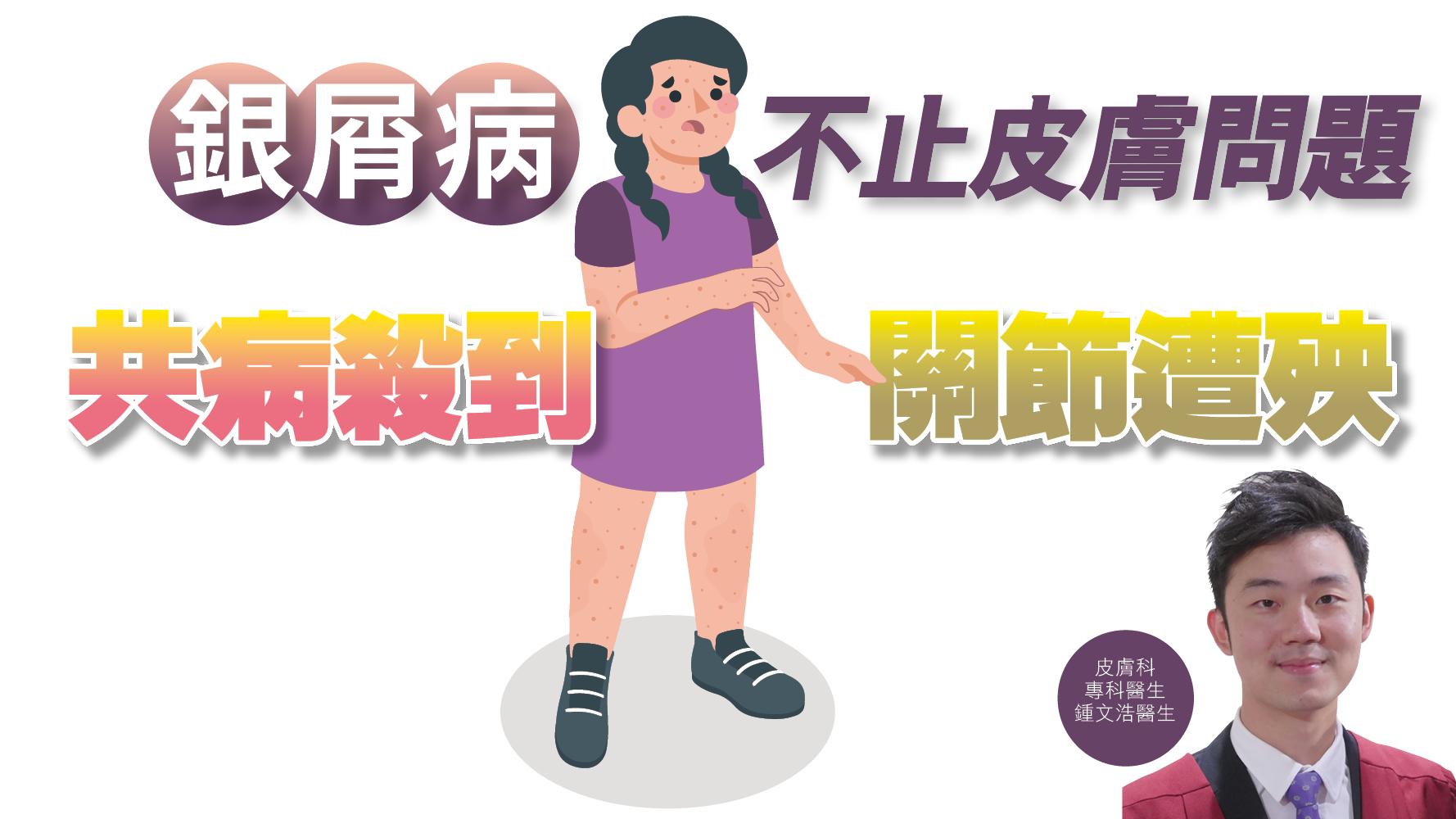 健康解碼｜銀屑病 不止皮膚問題 共病殺到 關節遭殃