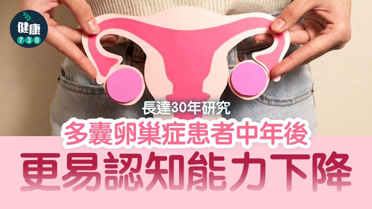 認知障礙｜長達30年研究 多囊卵巢症患者中年後更易認知能力下降
