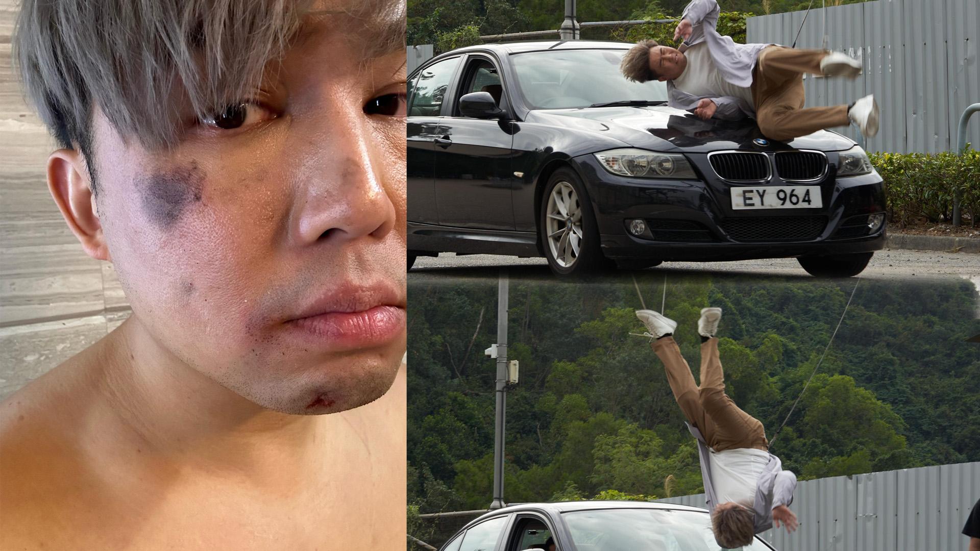 《造星III》旨呈自編自導自演兼玩命 拍撞車場口親身上陣周身瘀晒