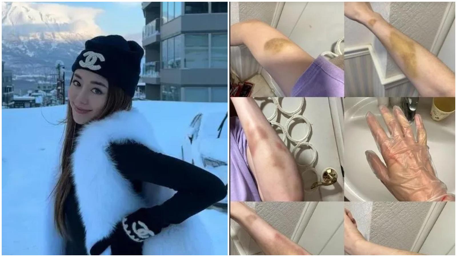 台灣藝人林千又控訴富商男友家暴　反被指當第三者致元配「一度想不開」