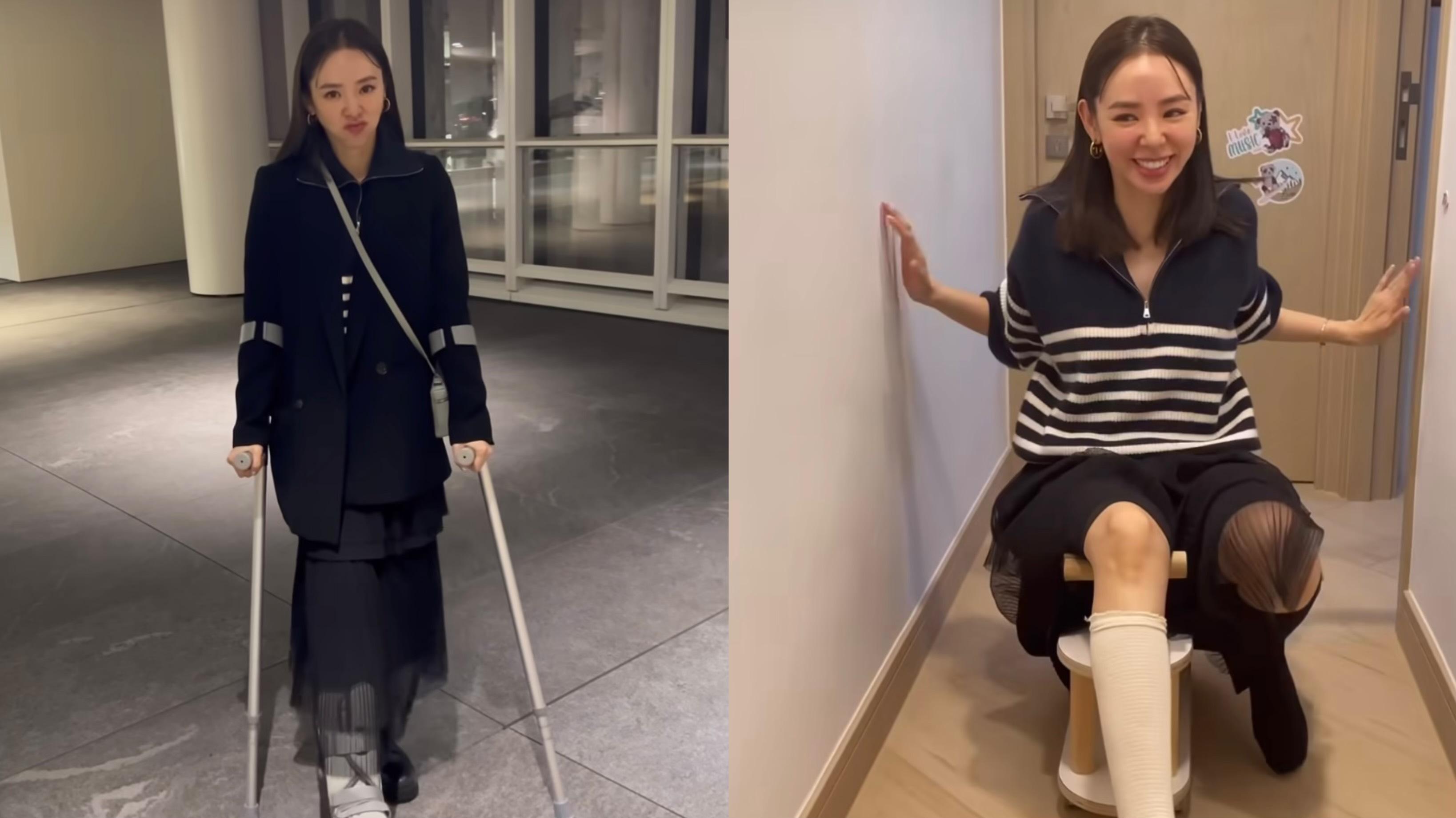 譚凱琪Zoie新年前夕拗柴打石膏 借囡囡滑行車代步