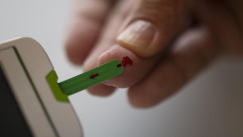 糖尿7件事攸關重大 45歲起篩查之重要