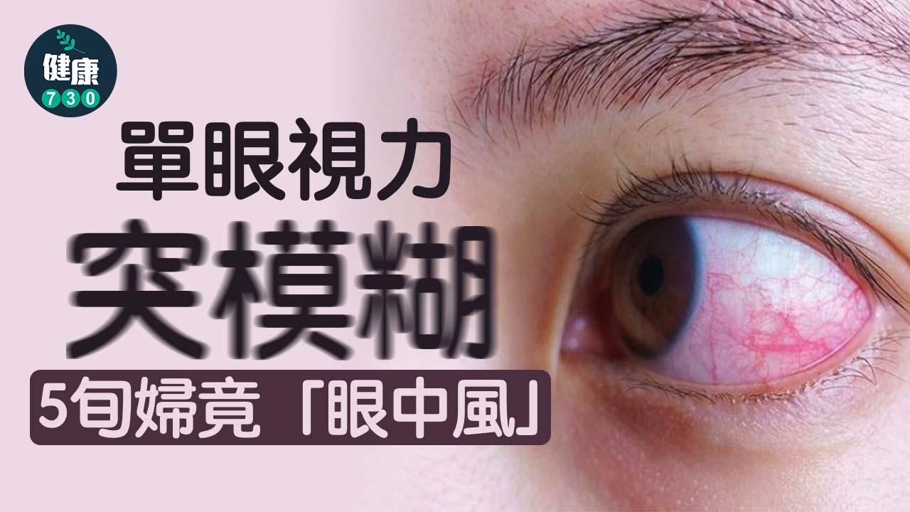 單眼視力突模糊　5旬婦竟「眼中風」