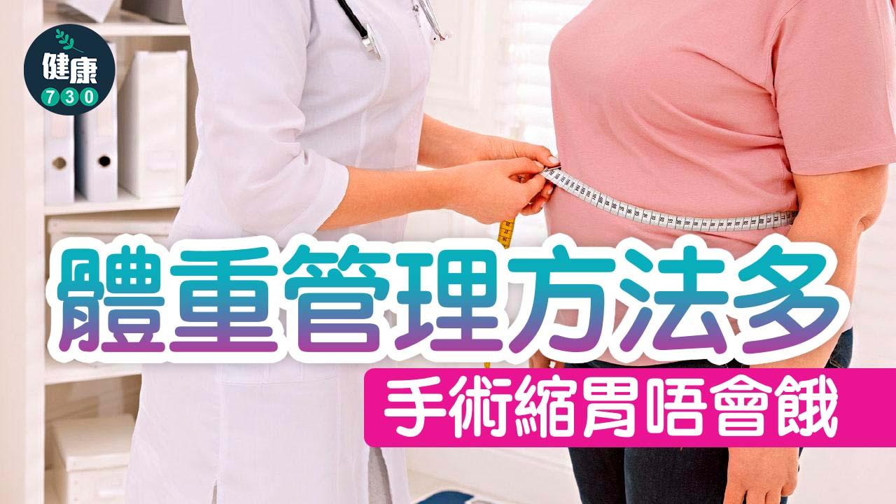 體重管理方法多 手術縮胃唔會餓