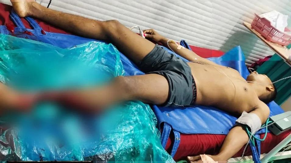 戈瓦里被鯊魚咬斷小腿，須截肢保命。(互聯網)