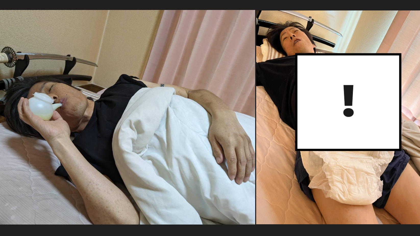 警世網紅曾日飲9升啤酒 剩一年命 腹大如西瓜 失肝功能 