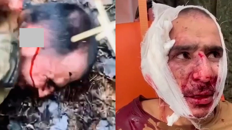 莫斯科恐襲｜俄警大報復 割下疑犯耳朵 再迫他吃下(慎入)