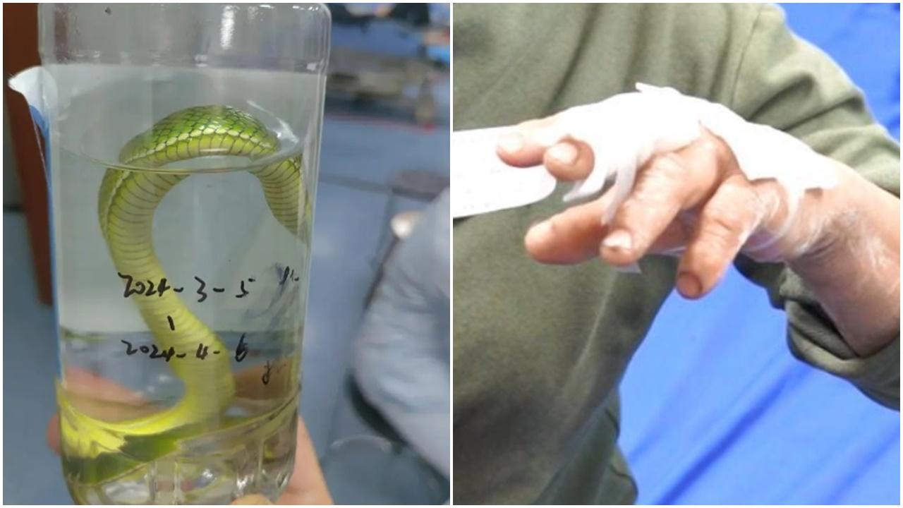 被咬一啖大媽拎毒蛇衝急症室求醫，醫生：不建議這樣做。(微博)