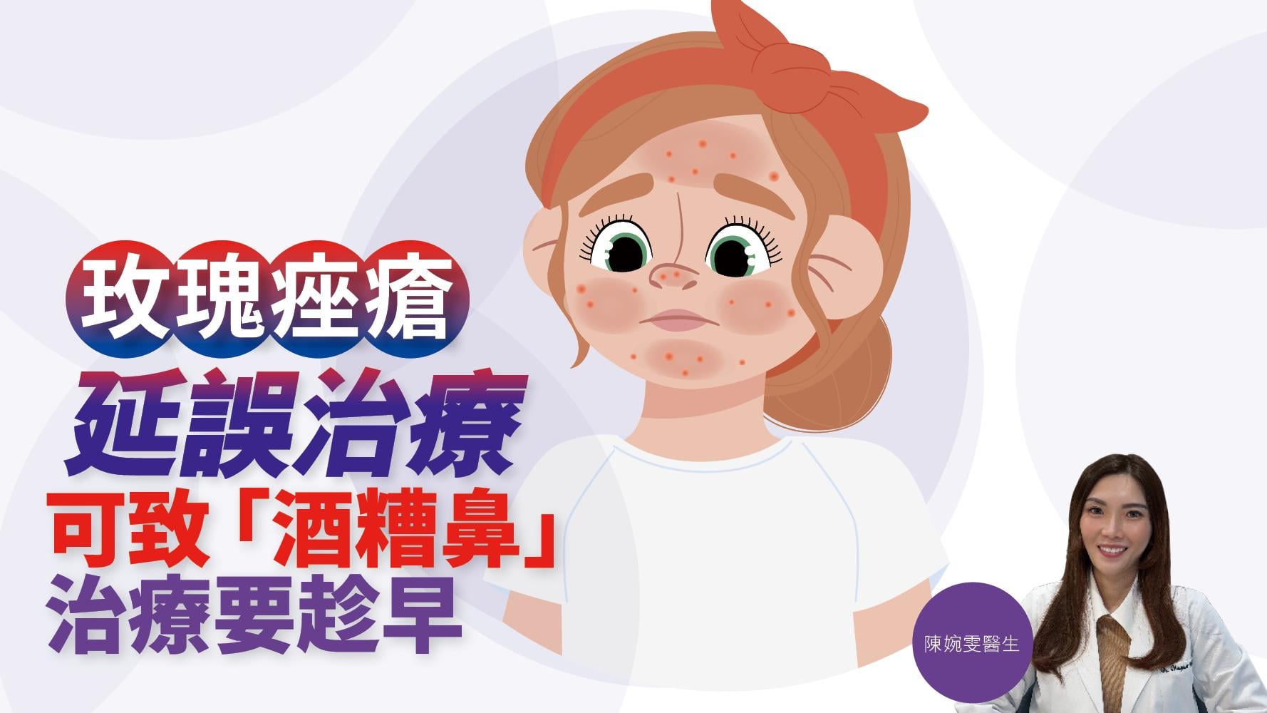 健康解碼｜玫瑰痤瘡延誤治療 可致「酒糟鼻」 治療要趁早 