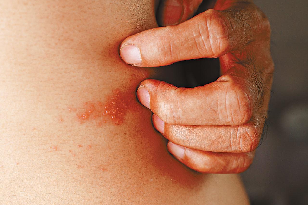 生仔咁痛？ 打針防生蛇後遺症