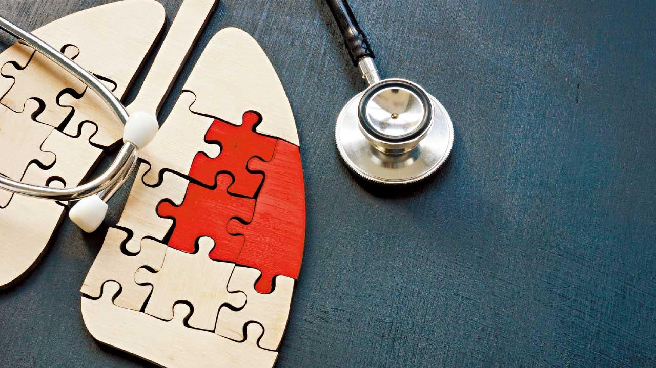 逾七成人確診屬晚期 八成人不吸煙 團體籲引入肺癌篩查