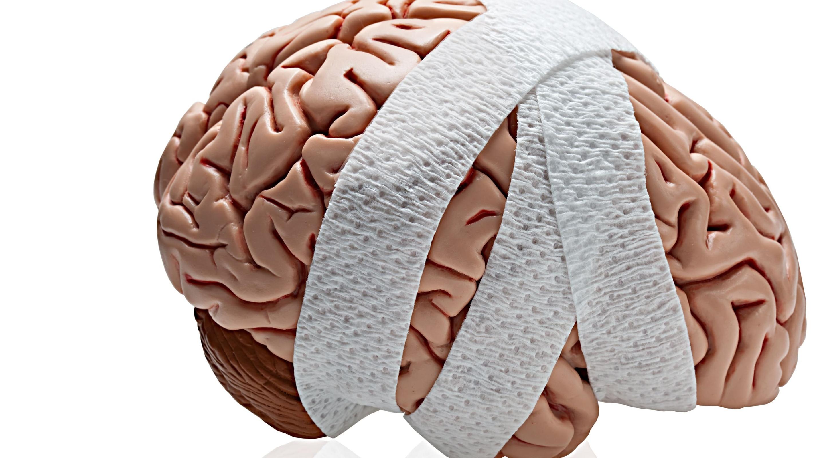 硬膜下血腫可大可小 致腦壓急升可奪命 長者尤其要小心