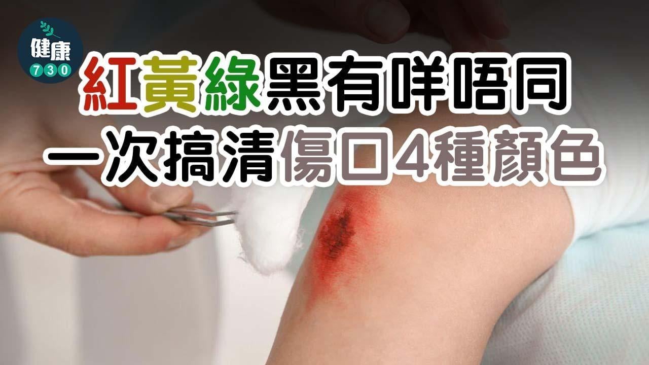 傷口顏色｜紅黃綠黑有咩唔同？小心處理加速癒合時間（am730製圖）