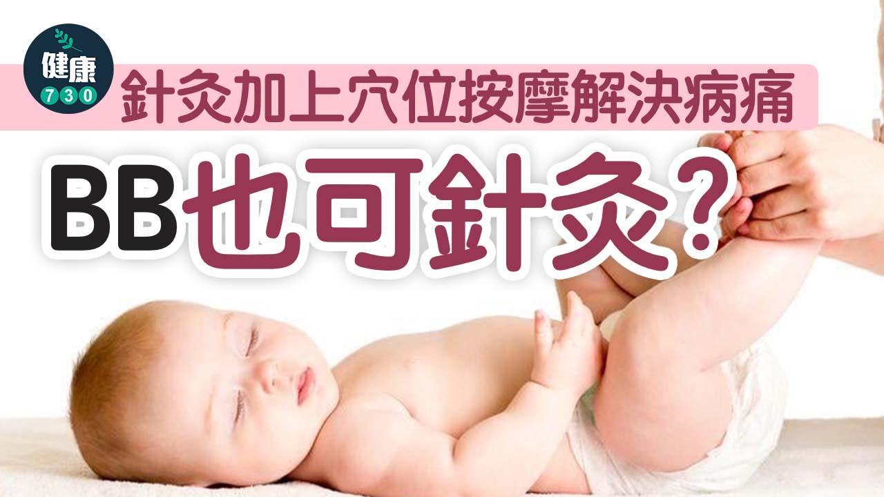 針灸加上穴位按摩解決病痛！BB也可針灸？