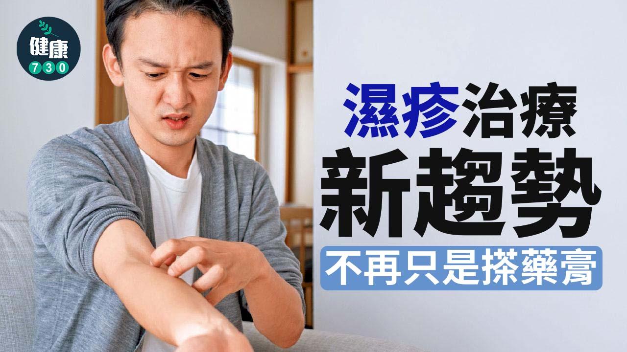濕疹治療新趨勢 不再只是搽藥膏