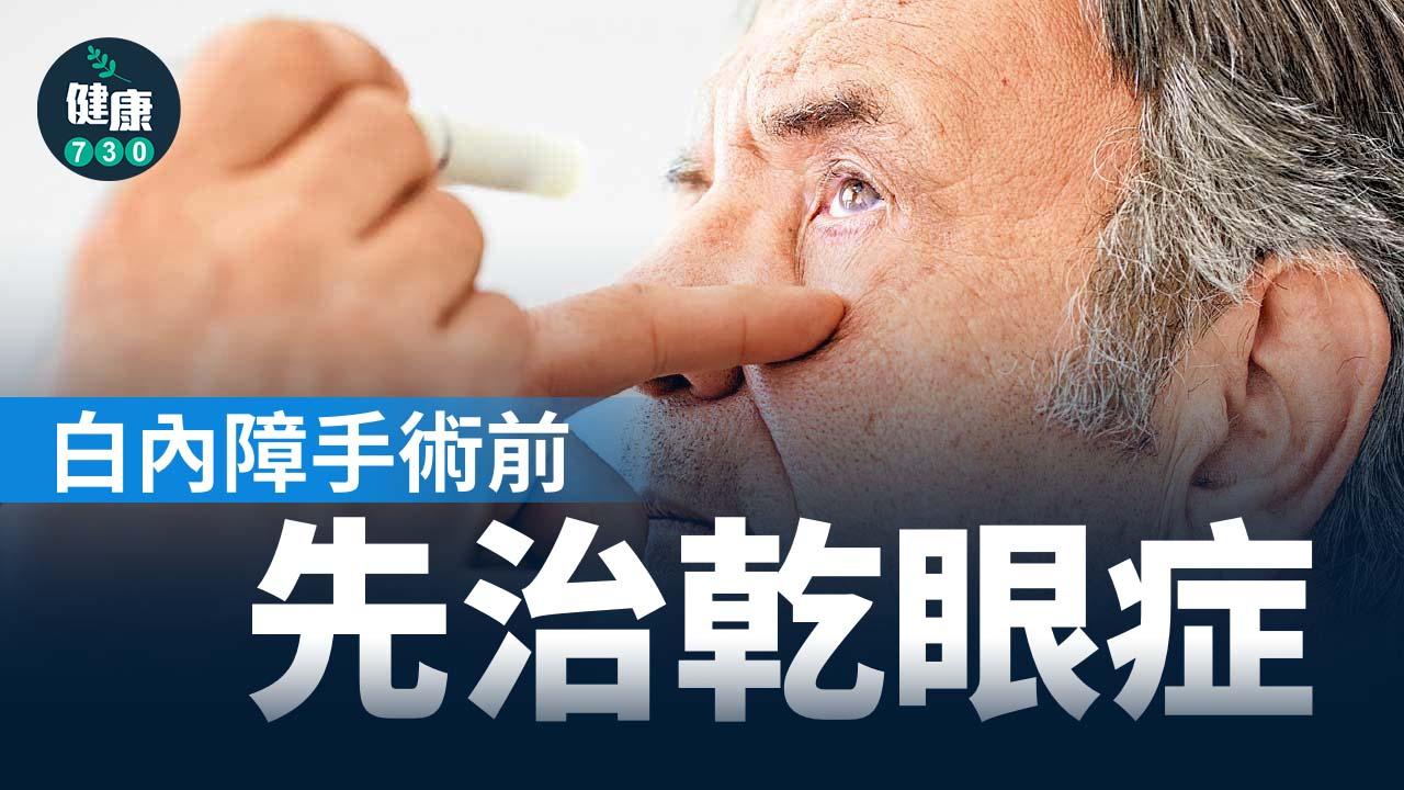 白內障手術前先治乾眼症