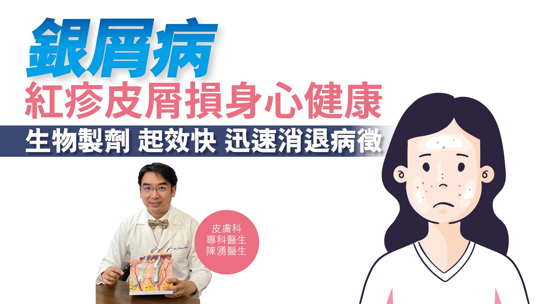 健康解碼｜銀屑病 紅疹皮屑損身心健康 生物製劑 起效快 迅速消退病徵