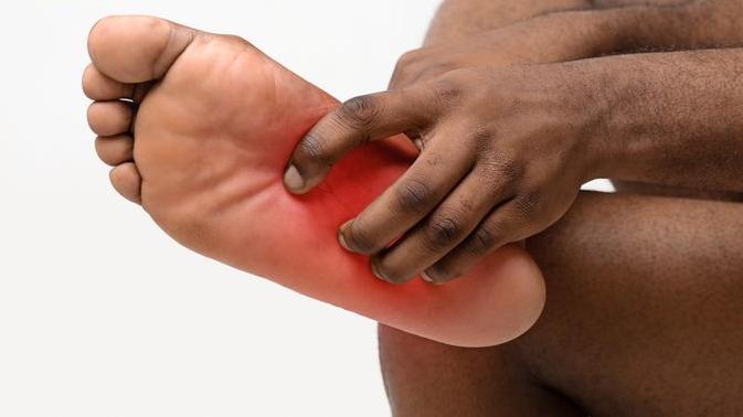  唔理香港腳 一旦感染蜂窩性組織炎或需截肢保命