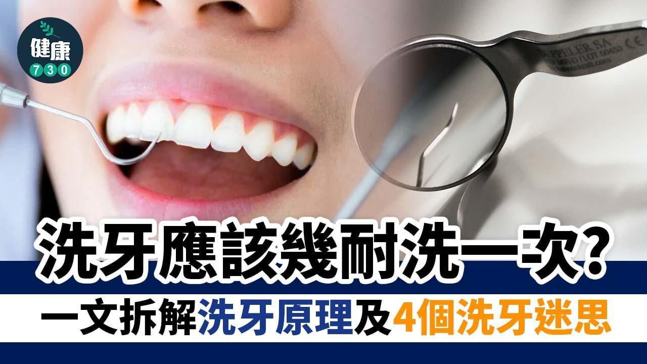 洗牙幾耐洗一次？為甚麼會流牙血？牙齒會變白？原理及4個迷思拆解