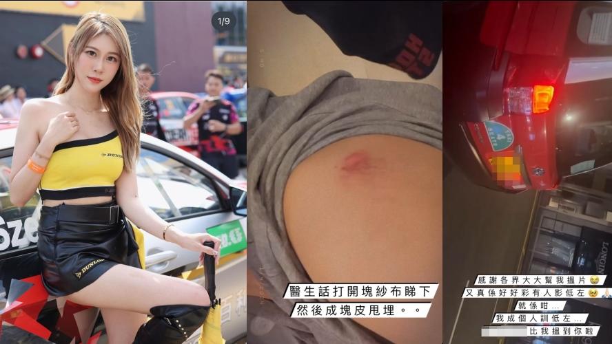 中環的士疑拒載突然開車走　28歲女車模遭拖行5米指：起床條頸冇力