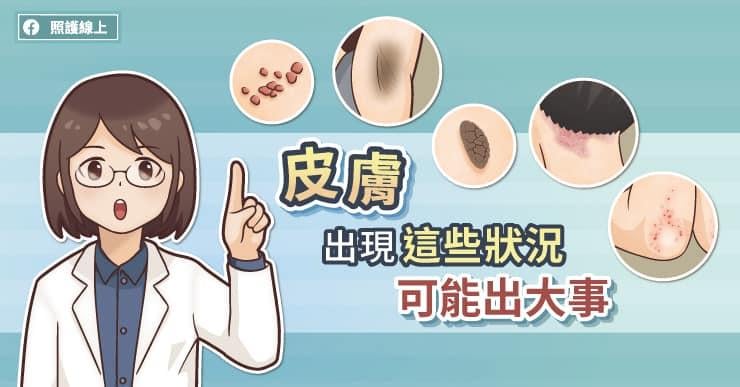  皮膚出現呢啲狀況要留意(圖文懶人包)