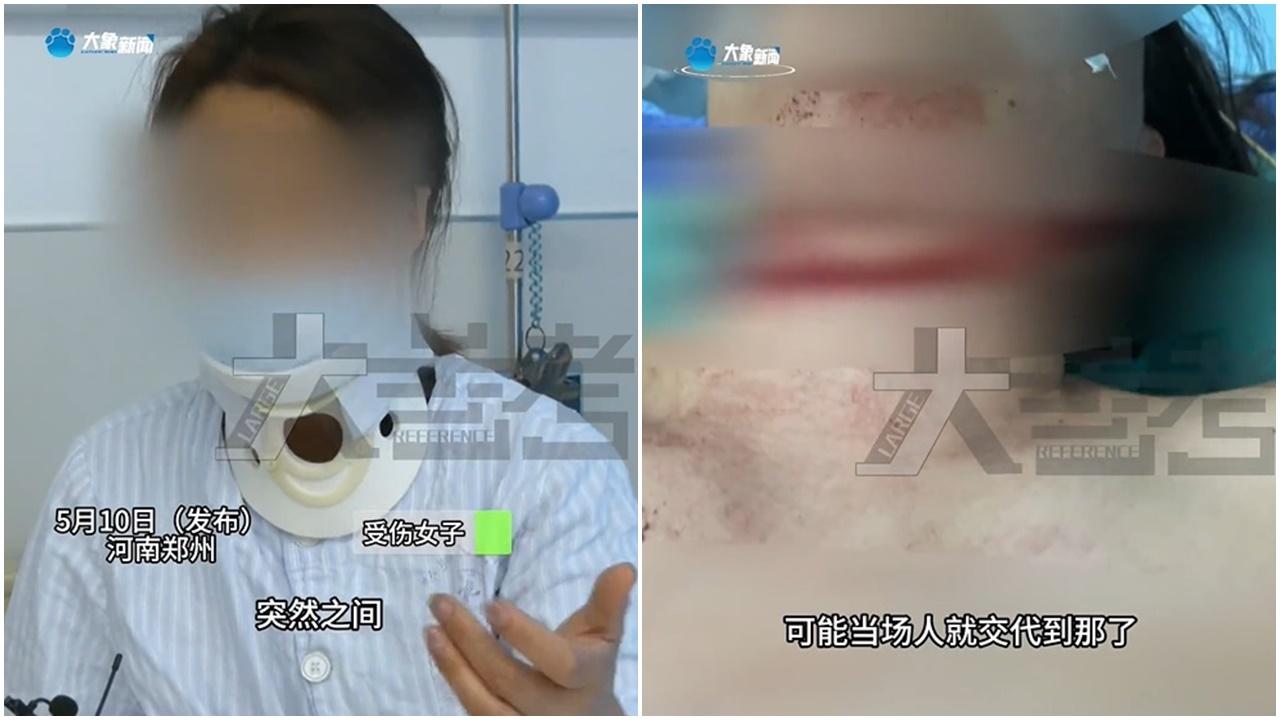 女子街上飛來橫禍遭風箏線𠝹頸，幸一個動作保住條命。(微博)