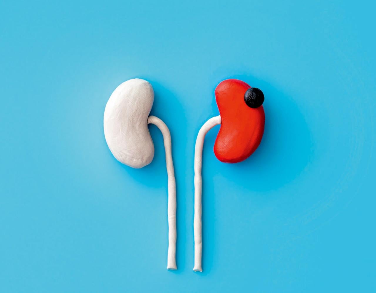 免疫+標靶 對抗晚期腎癌