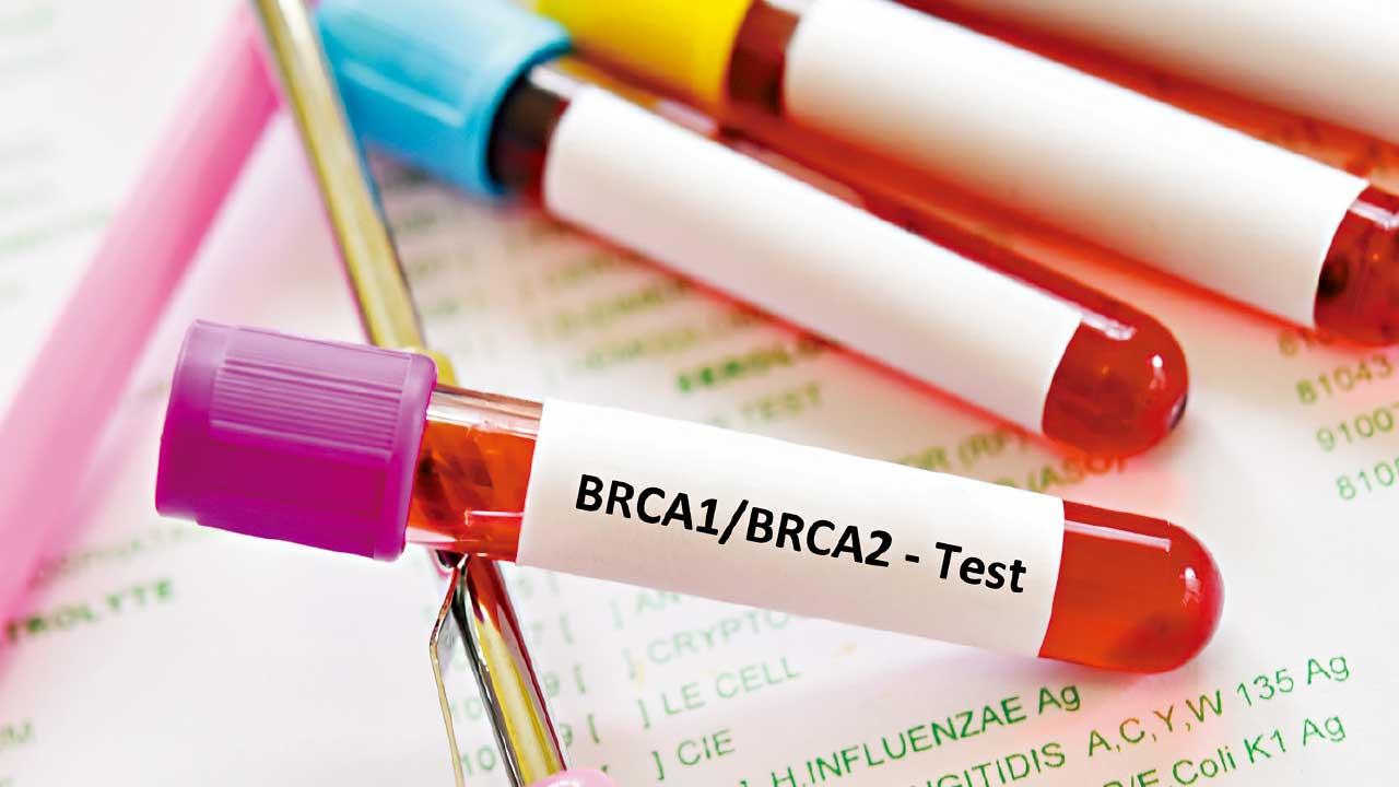 免費BRCA基因檢測 找靶點精準治療