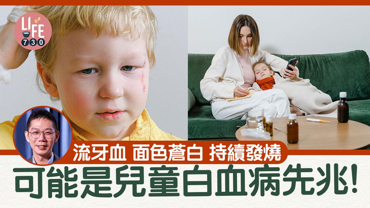 流牙血 面色蒼白 持續發燒 可能是兒童白血病先兆！