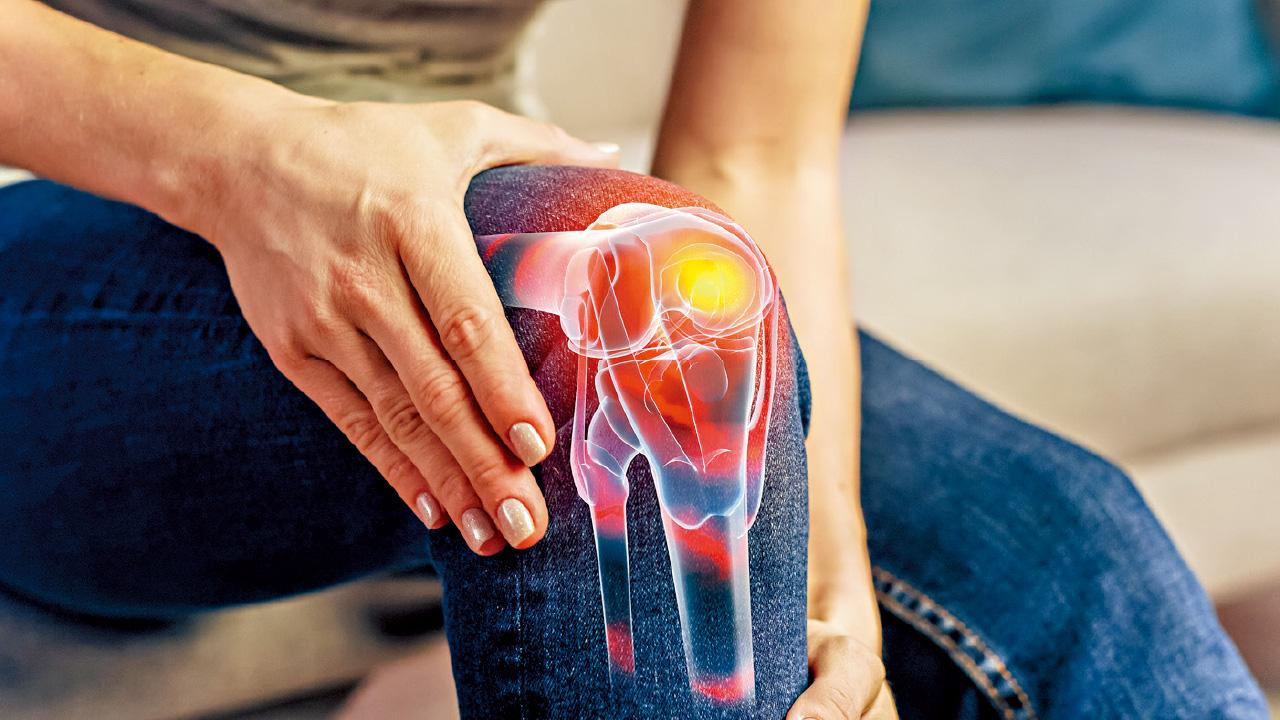 膝關節變形 無法逆轉 有痛盡快求醫