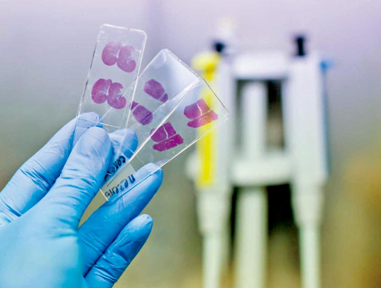 由顯微鏡到人工智能——淺談組織病理學的古往今來