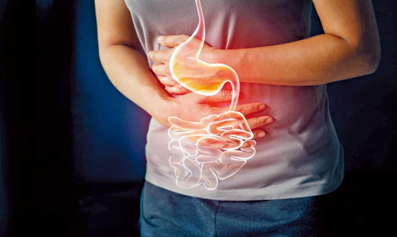 未病先防 既病防變 中醫治療腸化生