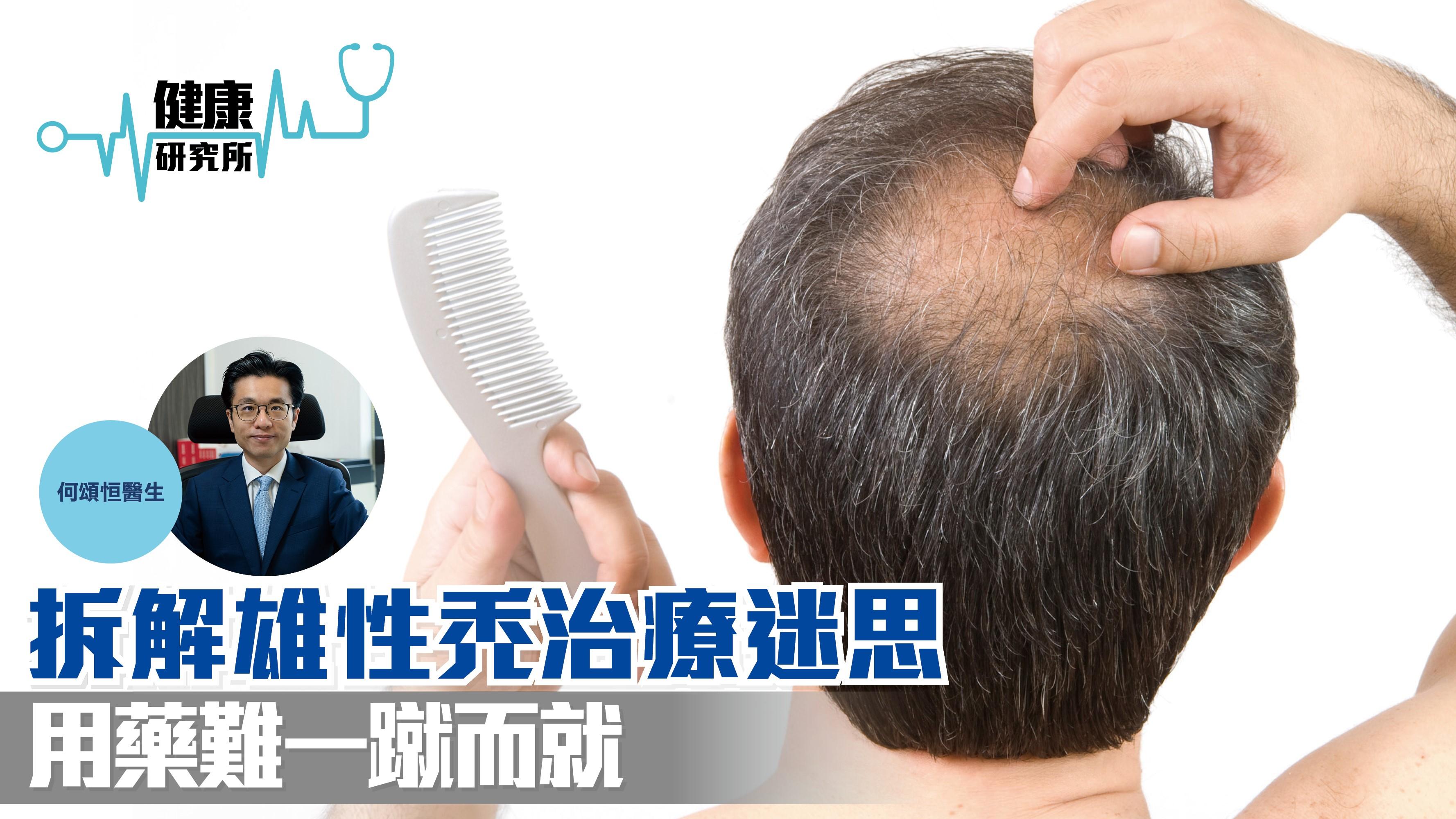 健康研究所｜拆解雄性禿治療迷思 用藥難一蹴而就