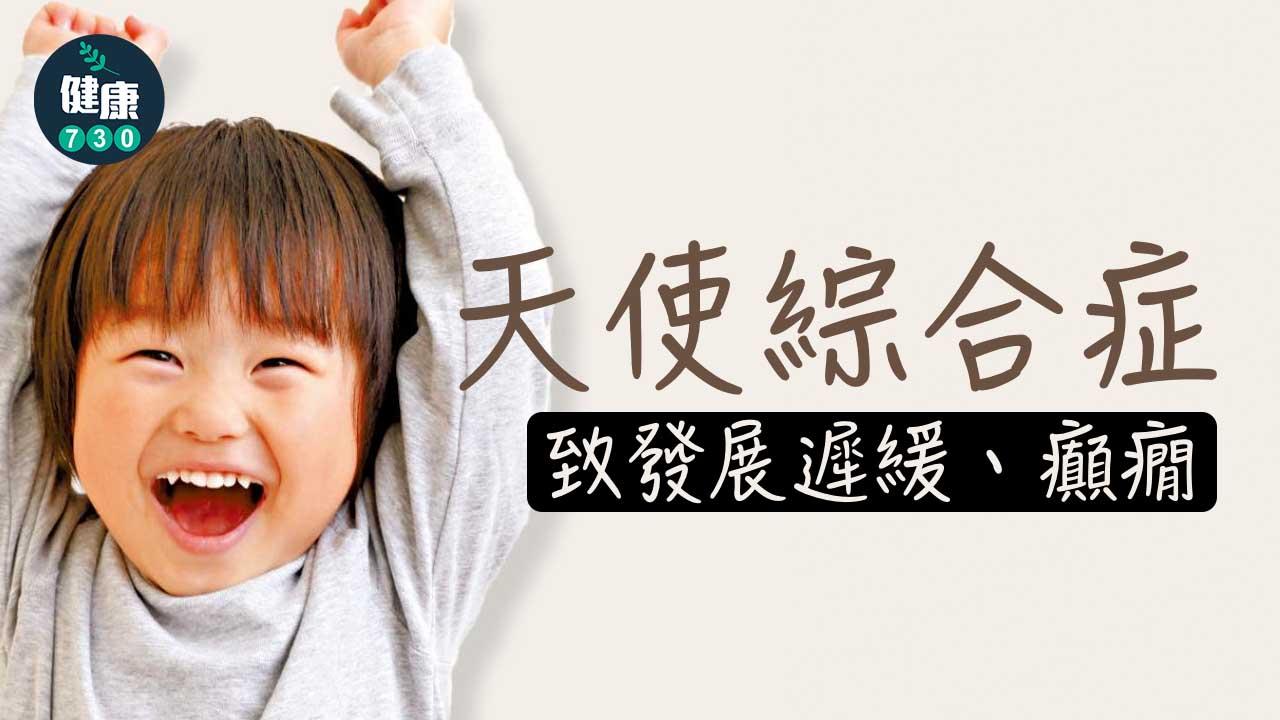 天使綜合症 致發展遲緩、癲癇