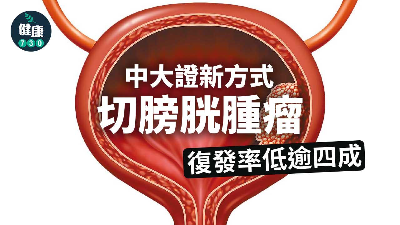 中大證新方式切膀胱腫瘤 復發率低逾四成