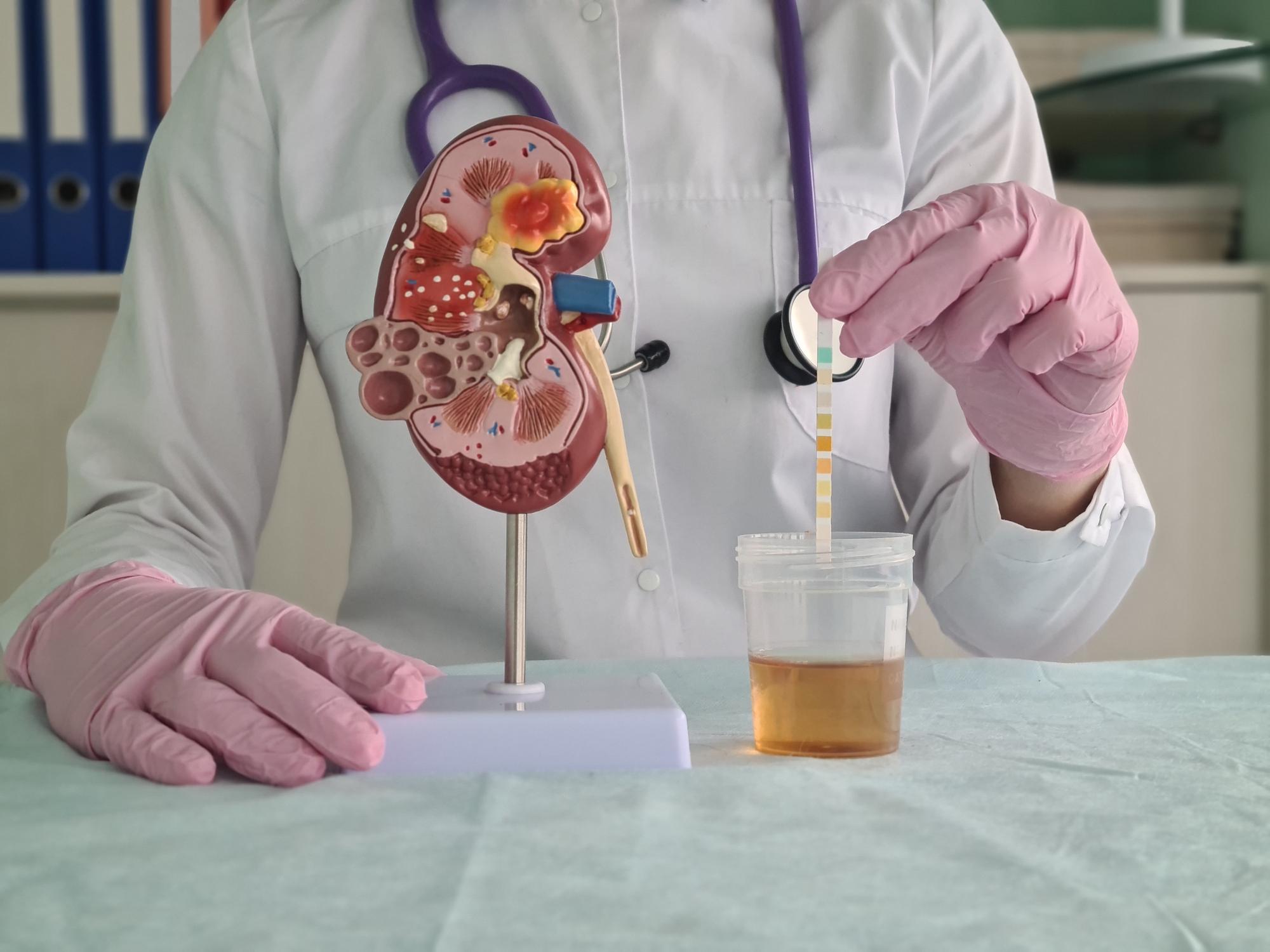 糖尿病腎病早期難察覺 團體料8月推慢性腎病免費篩查計劃 45歲以上中一個風險因素就可參加