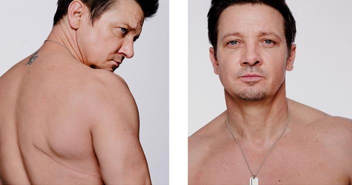 38處骨折 「鷹眼」謝洛美維納正式復原稱醫學奇蹟