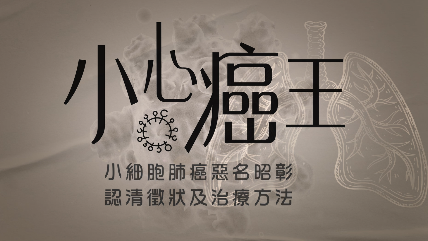 小心癌王｜小細胞肺癌惡名昭彰 認清徵狀及治療方法