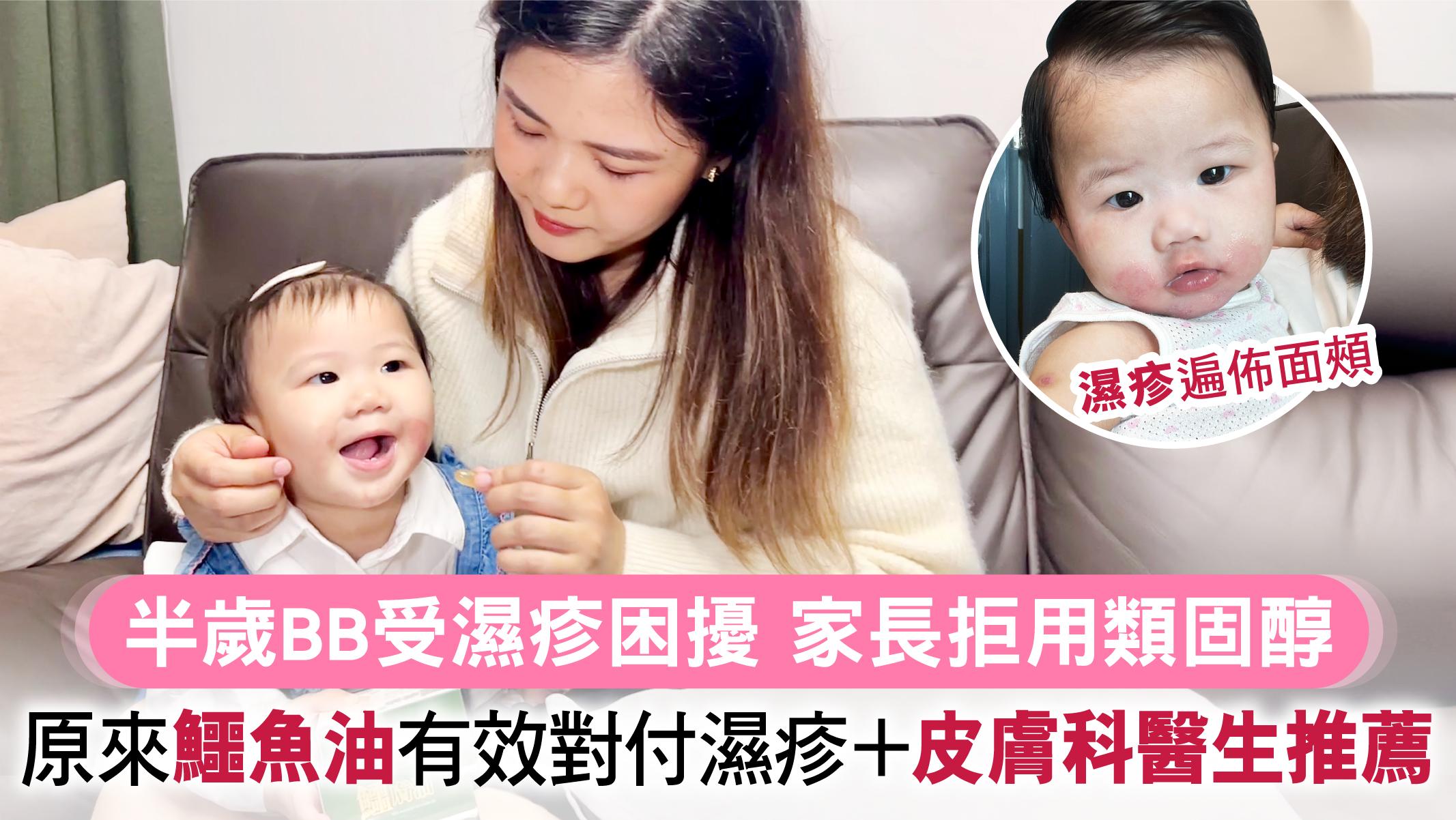 半歲BB受濕疹困擾 家長拒用類固醇  原來鱷魚油有效對付濕疹+皮膚科醫生推薦