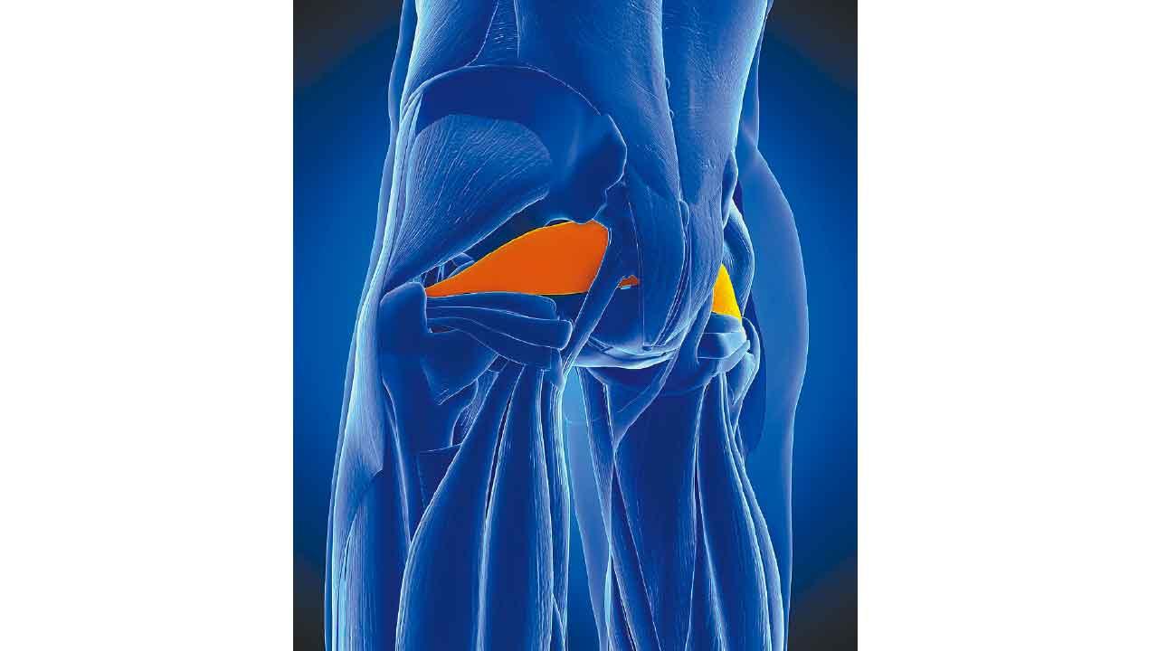 梨狀肌綜合症：辨別與紓緩臀部深層疼痛