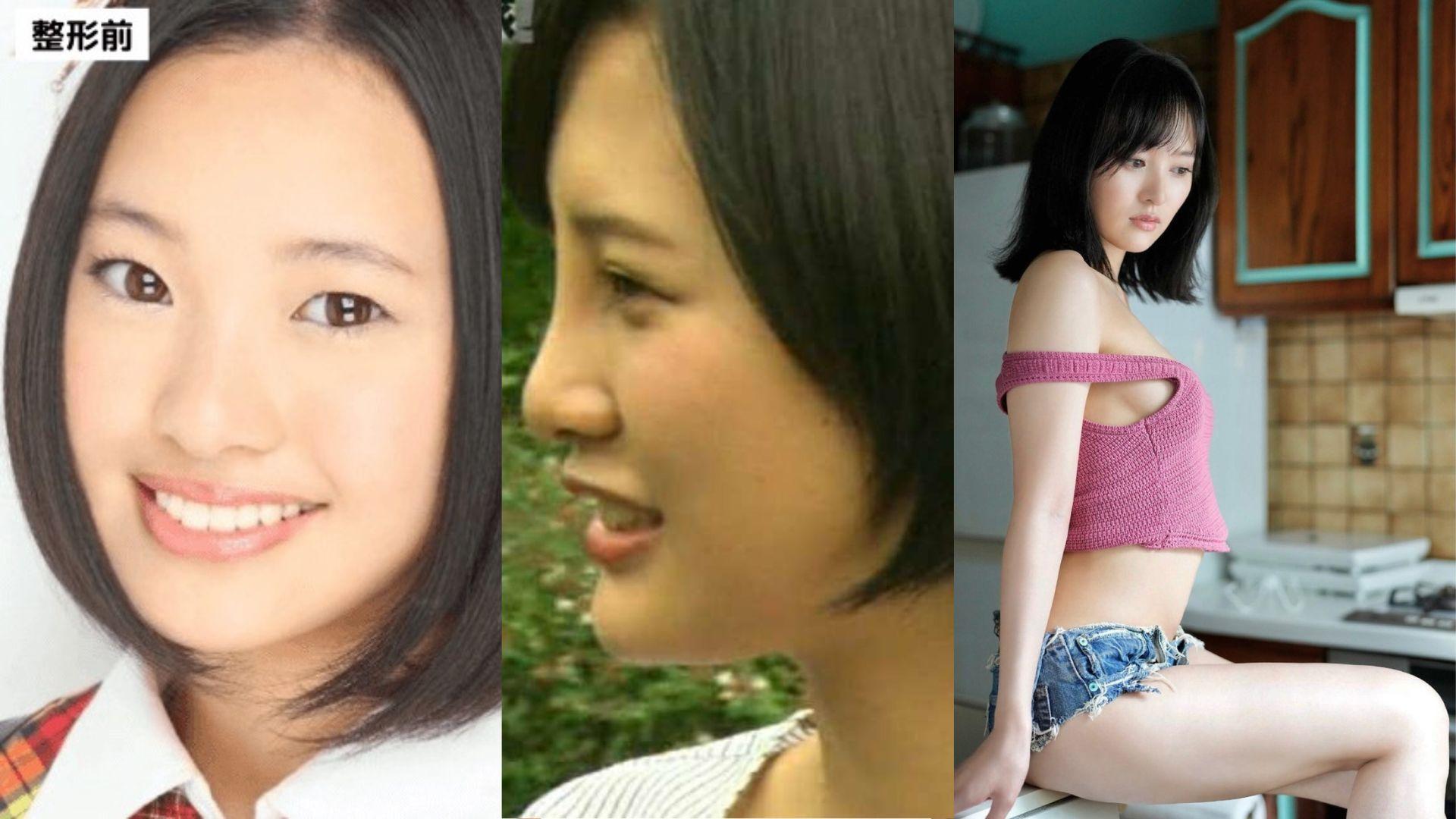 HKT48前主將兒玉遙變臉逾十年 認花1000萬日圓整容