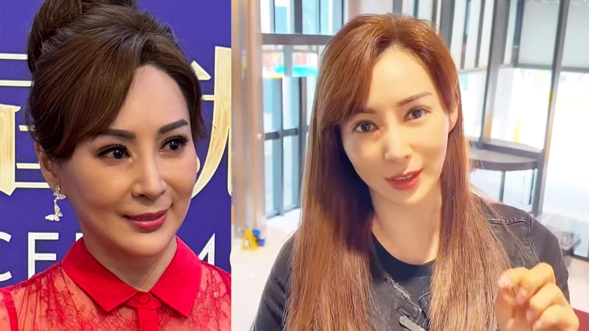 羅霖打抗生素入右眼 患淚囊炎變獨眼龍一星期