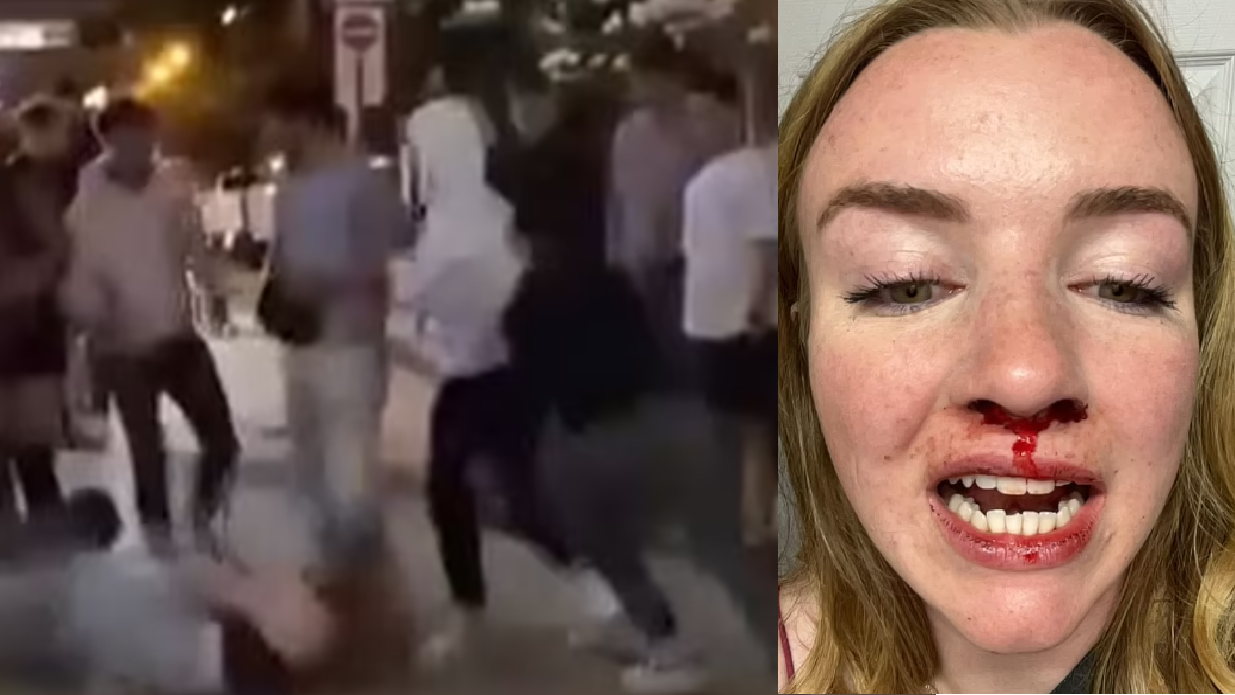 加拿大女同性戀情侶 遭10名中東男圍毆至爆鼻牙崩(有片)