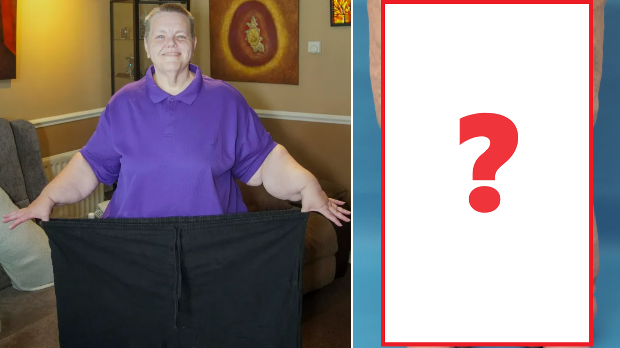 女子被丈夫瘋狂餵食至560磅 慘變「象人」無法站立 日飲6公升可樂