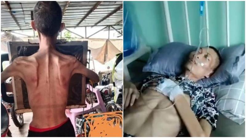 馬來西亞青年遭賣豬仔到緬北　皮包骨下獲救終在家摔倒亡